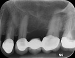 x-ray view