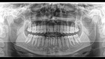 x-ray view
