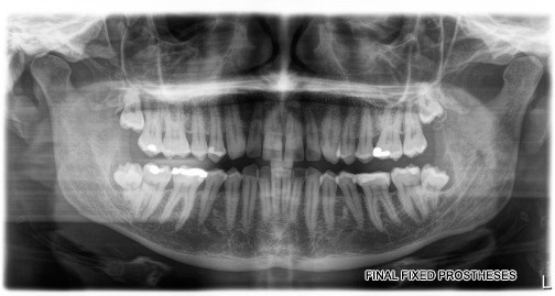 Dental x-ray