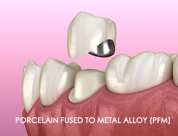 Responsive Thumbnail image 1