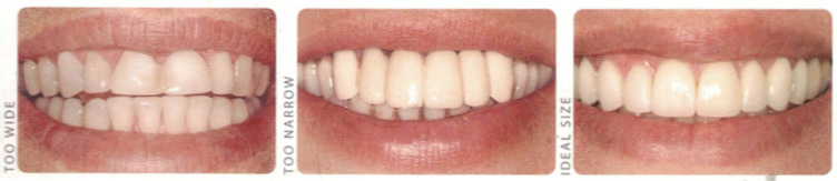 image 22